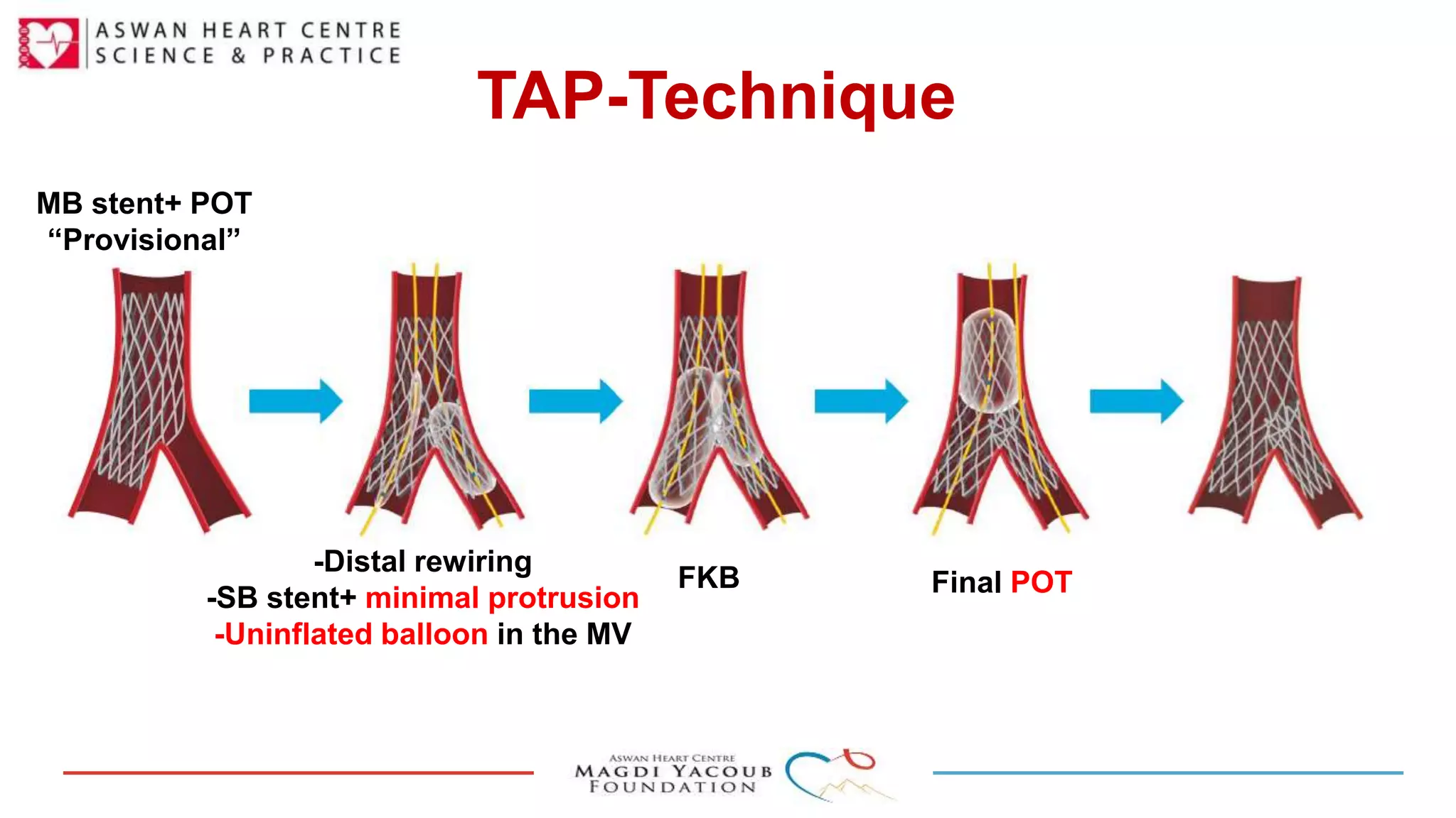 coronary-bifurcations-pptx