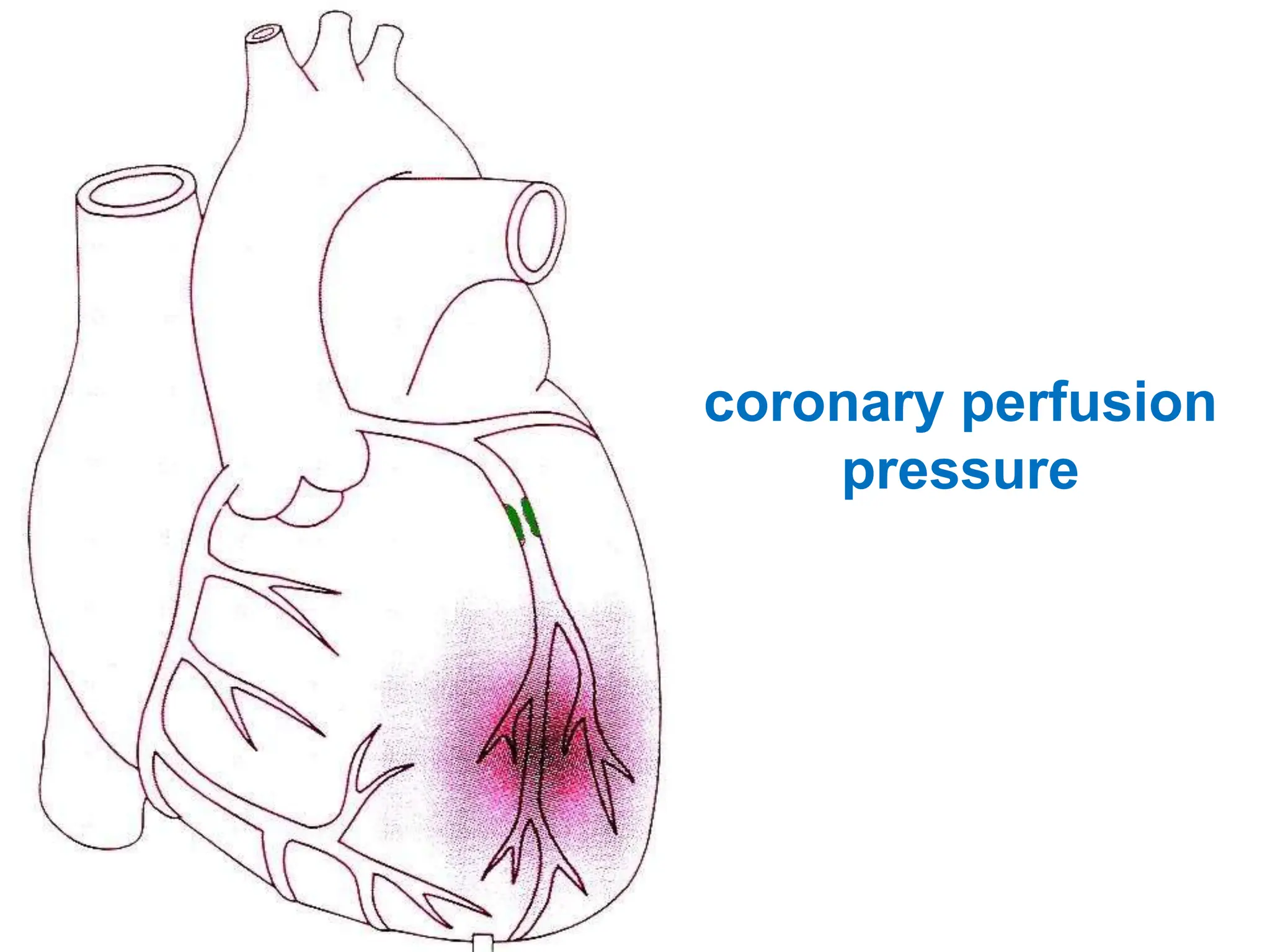 coronary perfusion
pressure
 