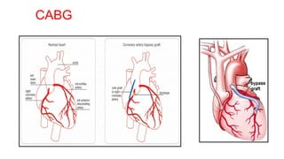 CORONARY CIRCULATION Cardiovascular system , Physiology | PDF
