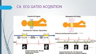 CA ECG GATED ACQISITION
 
