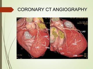 CORONARY CT ANGIOGRAPHY
 