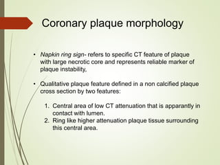 • Napkin ring sign- refers to specific CT feature of plaque
with large necrotic core and represents reliable marker of
plaque instability,
• Qualitative plaque feature defined in a non calcified plaque
cross section by two features:
1. Central area of low CT attenuation that is apparantly in
contact with lumen.
2. Ring like higher attenuation plaque tissue surrounding
this central area.
Coronary plaque morphology
 