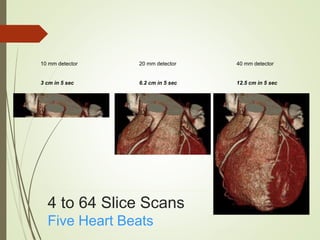 4 to 64 Slice Scans
Five Heart Beats
10 mm detector
3 cm in 5 sec
20 mm detector
6.2 cm in 5 sec
40 mm detector
12.5 cm in 5 sec
 