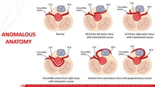 ANOMALOUS
ANATOMY
Loukas, M., Sharma, A., Blaak, C. et al. The Clinical Anatomy of the Coronary Arteries. J. of Cardiovasc. Trans. Res. 6, 197–207 (2013). DOI: https://doi.org/10.1007/s12265-013-9452-5
 