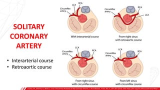 SOLITARY
CORONARY
ARTERY
• Interarterial course
• Retroaortic course
Loukas, M., Sharma, A., Blaak, C. et al. The Clinical Anatomy of the Coronary Arteries. J. of Cardiovasc. Trans. Res. 6, 197–207 (2013). DOI: https://doi.org/10.1007/s12265-013-9452-5
 