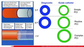 Brilakis, E. (2020). Manual of percutaneous coronary interventions: a step-by-step approach. Academic Press.
 