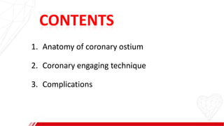 CONTENTS
1. Anatomy of coronary ostium
2. Coronary engaging technique
3. Complications
 