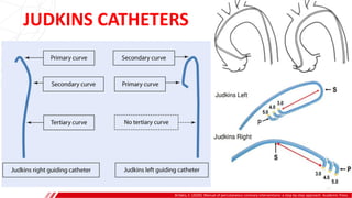 JUDKINS CATHETERS
Brilakis, E. (2020). Manual of percutaneous coronary interventions: a step-by-step approach. Academic Press.
 
