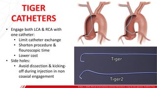 TIGER
CATHETERS
Brilakis, E. (2020). Manual of percutaneous coronary interventions: a step-by-step approach. Academic Press.
• Engage both LCA & RCA with
one catheter:
• Limit catheter exchange
• Shorten procedure &
flouroscopic time
• Lower cost
• Side holes:
• Avoid dissection & kicking-
off during injection in non
coaxial engagement
 