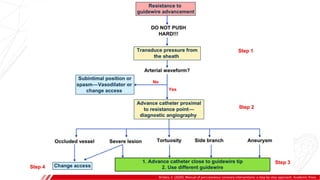 Brilakis, E. (2020). Manual of percutaneous coronary interventions: a step-by-step approach. Academic Press.
 