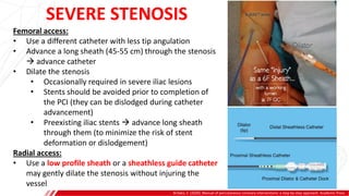 Brilakis, E. (2020). Manual of percutaneous coronary interventions: a step-by-step approach. Academic Press.
Femoral access:
• Use a different catheter with less tip angulation
• Advance a long sheath (45-55 cm) through the stenosis
 advance catheter
• Dilate the stenosis
• Occasionally required in severe iliac lesions
• Stents should be avoided prior to completion of
the PCI (they can be dislodged during catheter
advancement)
• Preexisting iliac stents  advance long sheath
through them (to minimize the risk of stent
deformation or dislodgement)
Radial access:
• Use a low profile sheath or a sheathless guide catheter
may gently dilate the stenosis without injuring the
vessel
SEVERE STENOSIS
 