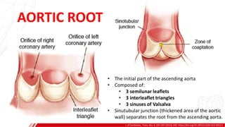 J. of Cardiovasc. Trans. Res. 6, 197–207 (2013). DOI: https://doi.org/10.1007/s12265-013-9452-5
AORTIC ROOT
• The initial part of the ascending aorta
• Composed of:
• 3 semilunar leaflets
• 3 interleaflet triangles
• 3 sinuses of Valsalva
• Sinutubular junction (thickened area of the aortic
wall) separates the root from the ascending aorta.
 