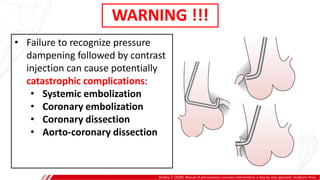 WARNING !!!
Brilakis, E. (2020). Manual of percutaneous coronary interventions: a step-by-step approach. Academic Press.
• Failure to recognize pressure
dampening followed by contrast
injection can cause potentially
catastrophic complications:
• Systemic embolization
• Coronary embolization
• Coronary dissection
• Aorto-coronary dissection
A
B
 