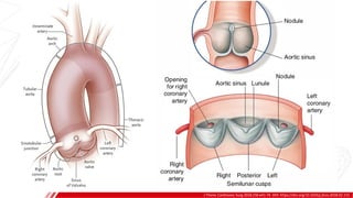 J Thorac Cardiovasc Surg 2018;156:e41-74. DOI: https://doi.org/10.1016/j.jtcvs.2018.02.115
 
