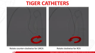 TIGER CATHETERS
Sakhuja, R., Gandhi, S. (2015). Diagnostic Coronary Angiography. DOI: 10.1007/978-3-642-37078-6_40.
A
B
Rotate counter-clockwise for LMCA Rotate clockwise for RCA
 