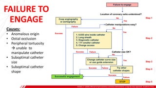 FAILURE TO
ENGAGE
Brilakis, E. (2020). Manual of percutaneous coronary interventions: a step-by-step approach. Academic Press.
A
B
Causes:
• Anomalous origin
• Ostial occlusion
• Peripheral tortuosity
 unable to
manipulate catheter
• Suboptimal catheter
size
• Suboptimal catheter
shape
 