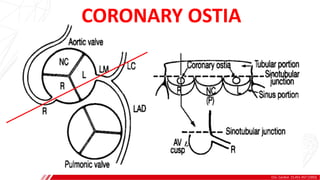 Clin. Cardiol. 15,451-457 (1992)
CORONARY OSTIA
 
