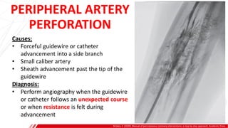 PERIPHERAL ARTERY
PERFORATION
Brilakis, E. (2020). Manual of percutaneous coronary interventions: a step-by-step approach. Academic Press.
Causes:
• Forceful guidewire or catheter
advancement into a side branch
• Small caliber artery
• Sheath advancement past the tip of the
guidewire
Diagnosis:
• Perform angiography when the guidewire
or catheter follows an unexpected course
or when resistance is felt during
advancement
 