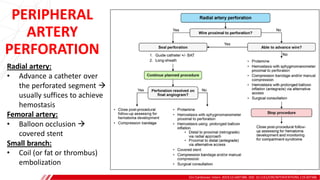 PERIPHERAL
ARTERY
PERFORATION
Circ Cardiovasc Interv. 2019;12:e007386. DOI: 10.1161/CIRCINTERVENTIONS.119.007386
Radial artery:
• Advance a catheter over
the perforated segment 
usually suffices to achieve
hemostasis
Femoral artery:
• Balloon occlusion 
covered stent
Small branch:
• Coil (or fat or thrombus)
embolization
 