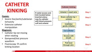 CATHETER
KINKING
Brilakis, E. (2020). Manual of percutaneous coronary interventions: a step-by-step approach. Academic Press.
A
B
Causes:
• Severe iliac/aortic/subclavian
tortuosity
• Extensive catheter
manipulation
Diagnosis:
• Catheter tip not moving
when rotating
• Dampened/lost pressure
waveform
• Fluoroscopy  confirm
kinking location
 