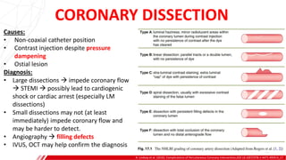 CORONARY DISSECTION
A. Lindsay et al. (2016). Complications of Percutaneous Coronary Intervention,DOI 10.1007/978-1-4471-4959-0_17
Causes:
• Non-coaxial catheter position
• Contrast injection despite pressure
dampening
• Ostial lesion
Diagnosis:
• Large dissections  impede coronary flow
 STEMI  possibly lead to cardiogenic
shock or cardiac arrest (especially LM
dissections)
• Small dissections may not (at least
immediately) impede coronary flow and
may be harder to detect.
• Angiography  filling defects
• IVUS, OCT may help confirm the diagnosis
 