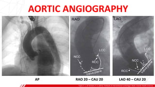 Topol, E. J., & Teirstein, P. S. (2015). Textbook of interventional cardiology E-Book. Elsevier Health Sciences.
AP RAO 20 – CAU 20 LAO 40 – CAU 20
AORTIC ANGIOGRAPHY
 