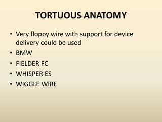 TORTUOUS ANATOMY
• Very floppy wire with support for device
delivery could be used
• BMW
• FIELDER FC
• WHISPER ES
• WIGGLE WIRE
 