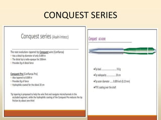 CONQUEST SERIES
 