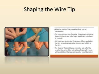 Shaping the Wire Tip
 