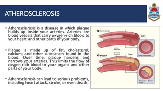 Coronary heart disease | PPTX