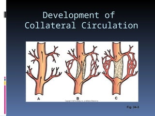 Coronary heart disease-powerpoint presentation | PPT