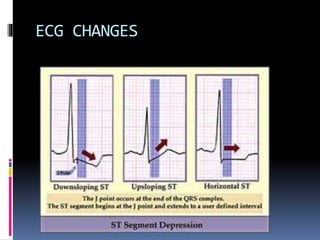 ECG CHANGES
 