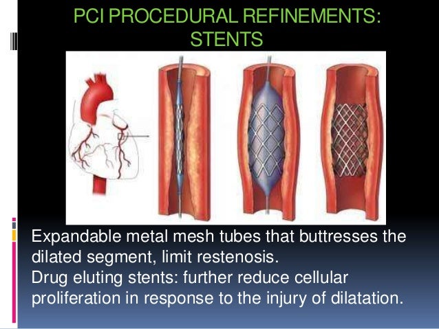 Heart Disease And Stents Cardiovascular Disease