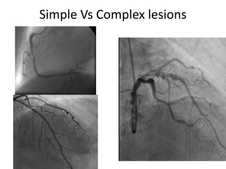Simple Vs Complex lesions
 