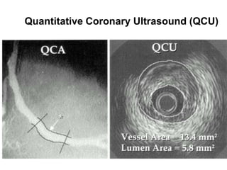 Quantitative Coronary Ultrasound (QCU)
 