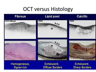 OCT versus Histology
 