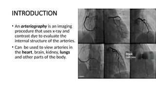 Comprehensive Guide to Coronary and Pulmonary Arteriography Procedures ...