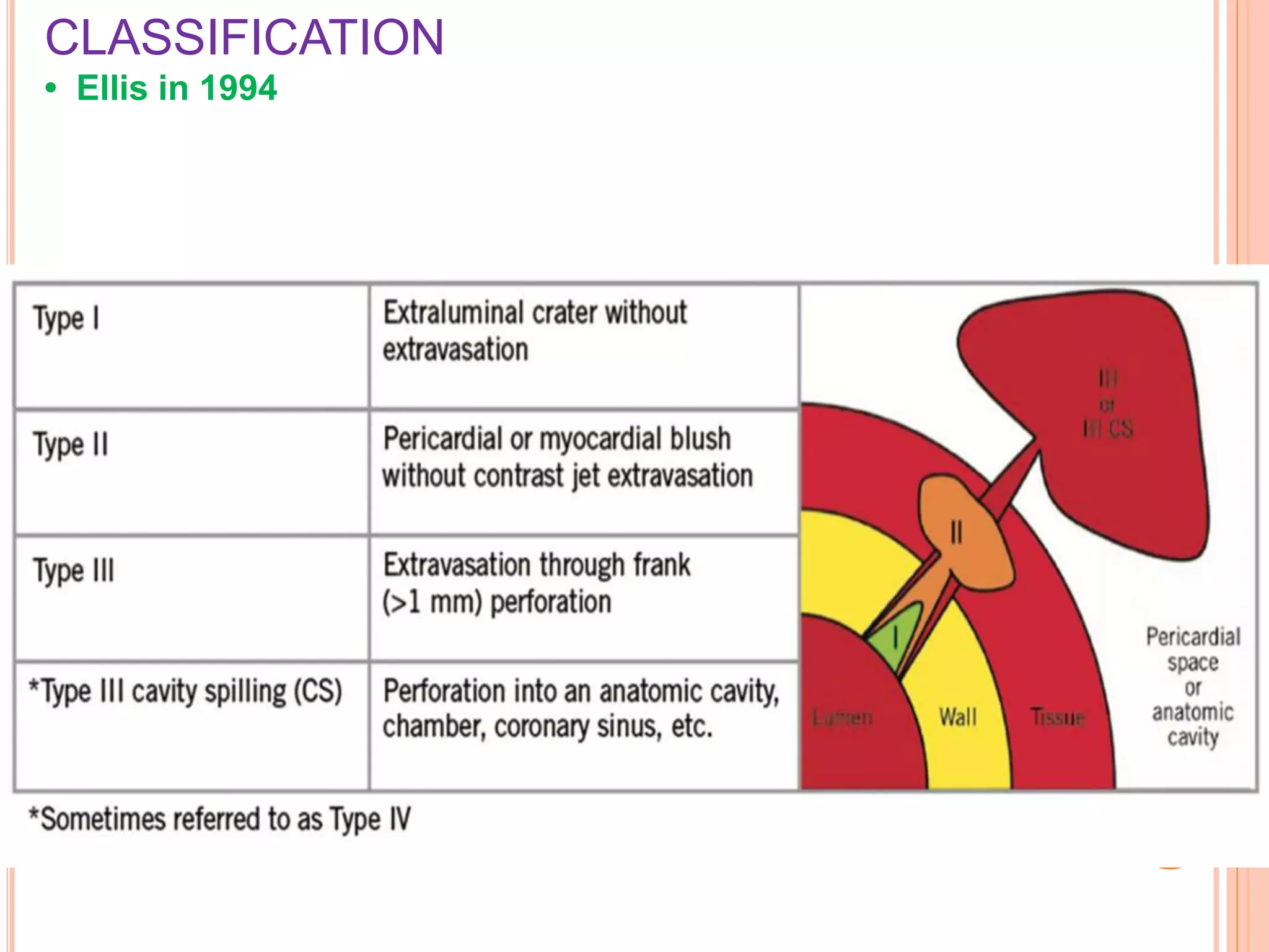 Perforation Classification CORONARY PERFORATION ABHISHEK1.pptx | First Aid | Injuries