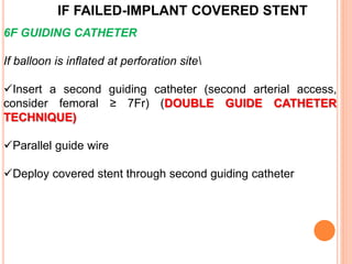 IF FAILED-IMPLANT COVERED STENT
6F GUIDING CATHETER
If balloon is inflated at perforation site
Insert a second guiding catheter (second arterial access,
consider femoral ≥ 7Fr) (DOUBLE GUIDE CATHETER
TECHNIQUE)
Parallel guide wire
Deploy covered stent through second guiding catheter
 