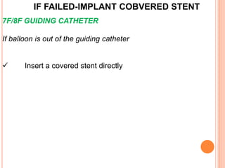 IF FAILED-IMPLANT COBVERED STENT
7F/8F GUIDING CATHETER
If balloon is out of the guiding catheter
 Insert a covered stent directly
 