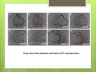 X-ray view of the phantom and fusion of CT reconstruction.
 