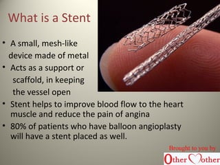 What is a Stent
• A small, mesh-like
device made of metal
• Acts as a support or
scaffold, in keeping
the vessel open
• Stent helps to improve blood flow to the heart
muscle and reduce the pain of angina
• 80% of patients who have balloon angioplasty
will have a stent placed as well.
Brought to you by
 