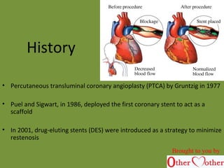 History
• Percutaneous transluminal coronary angioplasty (PTCA) by Gruntzig in 1977
• Puel and Sigwart, in 1986, deployed the first coronary stent to act as a
scaffold
• In 2001, drug-eluting stents (DES) were introduced as a strategy to minimize
restenosis
Brought to you by
 