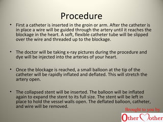 Procedure
• First a catheter is inserted in the groin or arm. After the catheter is
in place a wire will be guided through the artery until it reaches the
blockage in the heart. A soft, flexible catheter tube will be slipped
over the wire and threaded up to the blockage.
• The doctor will be taking x-ray pictures during the procedure and
dye will be injected into the arteries of your heart.
• Once the blockage is reached, a small balloon at the tip of the
catheter will be rapidly inflated and deflated. This will stretch the
artery open.
• The collapsed stent will be inserted. The balloon will be inflated
again to expand the stent to its full size. The stent will be left in
place to hold the vessel walls open. The deflated balloon, catheter,
and wire will be removed.
Brought to you by
 