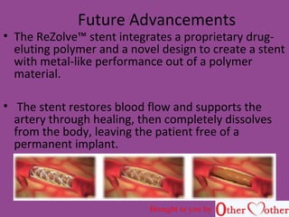 Future Advancements
• The ReZolve™ stent integrates a proprietary drug-
eluting polymer and a novel design to create a stent
with metal-like performance out of a polymer
material.
• The stent restores blood flow and supports the
artery through healing, then completely dissolves
from the body, leaving the patient free of a
permanent implant.
Brought to you by
 