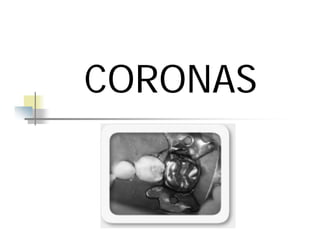 CORONAS
CORONAS
 