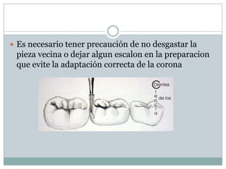  Es necesario tener precaución de no desgastar la
pieza vecina o dejar algun escalon en la preparacion
que evite la adaptación correcta de la corona
 