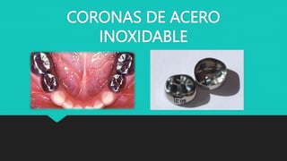 CORONAS DE ACERO
INOXIDABLE
 