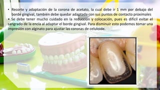 • Recorte y adaptación de la corona de acetato, la cual debe ir 1 mm por debajo del
borde gingival, también debe quedar adaptada con sus puntos de contacto proximales
• Se debe tener mucho cuidado en la reducción y colocación, pues es difícil evitar el
sangrado de la encía al adaptar el borde gingival. Para disminuir esto podemos tomar una
impresión con alginato para ajustar las coronas de celuloide.
 