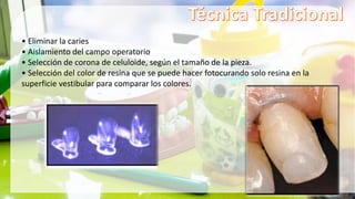 • Eliminar la caries
• Aislamiento del campo operatorio
• Selección de corona de celuloide, según el tamaño de la pieza.
• Selección del color de resina que se puede hacer fotocurando solo resina en la
superficie vestibular para comparar los colores.
 